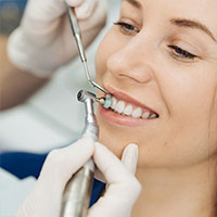 Dental Scaling and Polishing in Kukatpally